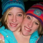 conjoined twins